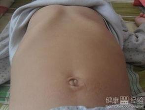 成人鸡胸呼吸矫正视频,轻松掌握成人鸡胸呼吸矫正技巧